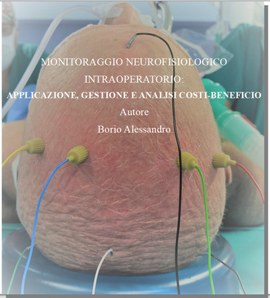 MONITORAGGIO NEUROFISIOLOGICO INTRAOPERATORIO: APPLICAZIONE, GESTIONE E ANALISI COSTI-BENEFICIO