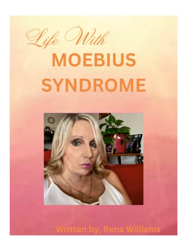 Life with Mobius Syndrome
