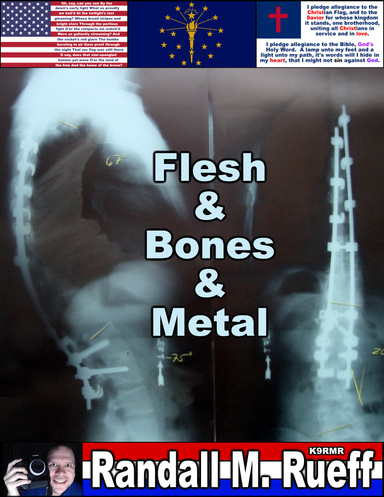 Flesh & Bones & Metal
