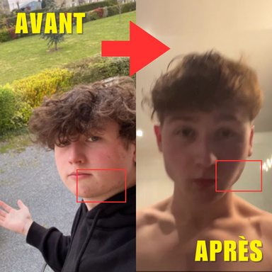 Comment maigrir du visage ?