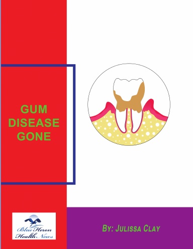 Gum Disease Gone