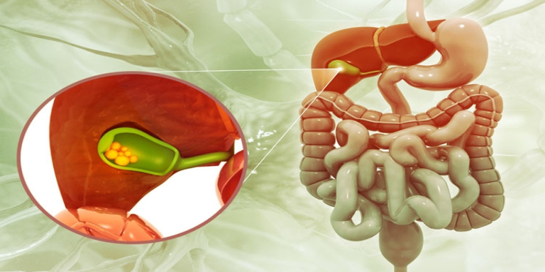 Gallbladder Removal When is it Necessary