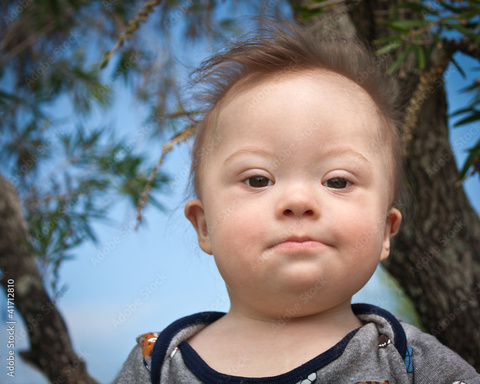 Parental Grief on Disability