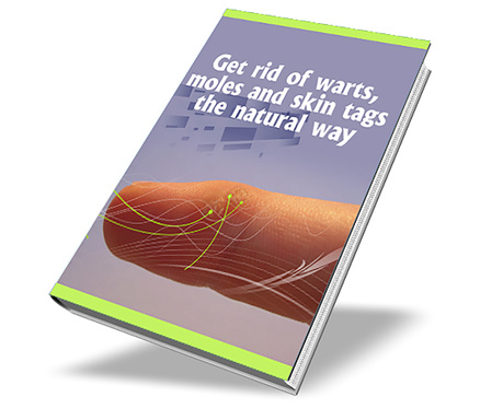 Get rid of warts, moles and skin tags the natural way