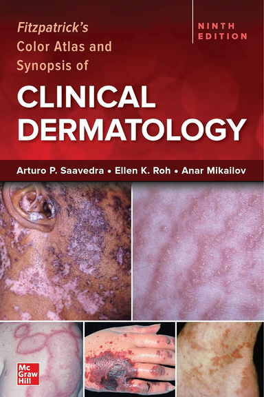 Fitzpatrick's Color Atlas and Synopsis of Clinical Dermatology, Ninth Edition 9th Edition