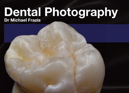 Dental Photography